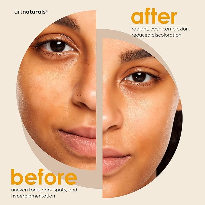 Kojic Acid Soap + African Net Sponge (2 pack X 142g Turmeric bars) Dark spot remover & Scars - Original Japanese Complex Vitamin C, Hyaluronic Acid, retinol, shea butter (Citrus)