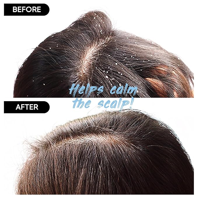 Red Bean Shampoo Bar 2.0 - Hydrating & Moisturizing Natural Hair Soap Bar Shampoo for Hair Color & Scalp Nourishment - Bathing Soap Solid Shampoo for All Hair Types (120g, 4.23oz)