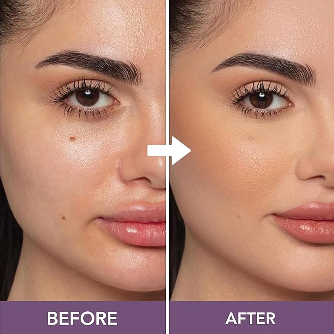 Dermaflage Waterproof Concealer Cream (Medium Cool) - Concealer Full Coverage, Matte Finish for Face & Body - Hides Dark Circles, Tattoos & Acne - Long Lasting Formula Used by Hollywood Makeup Artists