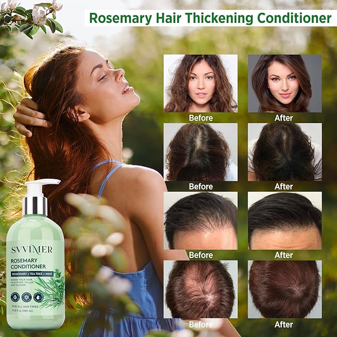 Rosemary Hair Growth Conditioner: Thickening Moisturizing Product with Biotin for Women Men - for Damaged Dry Thinning Hair 11.8 fl.oz