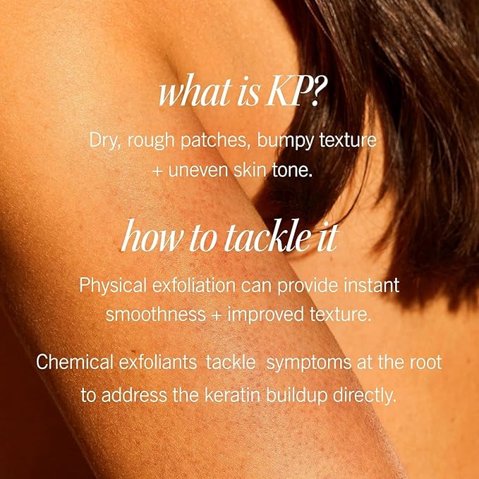 First Aid Beauty KP Bump Eraser Body Scrub Exfoliant for Keratosis Pilaris with 10% AHA 2 oz.