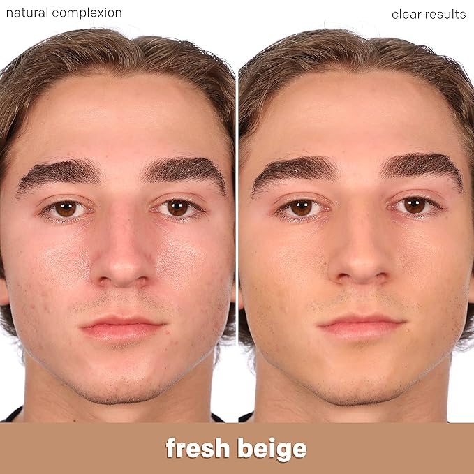 Almay Clear Complexion Acne Foundation Makeup with Salicylic Acid - Lightweight, Medium Coverage, Hypoallergenic, Fragrance-Free, for Sensitive Skin, 500 Fresh Beige, 1 fl oz.