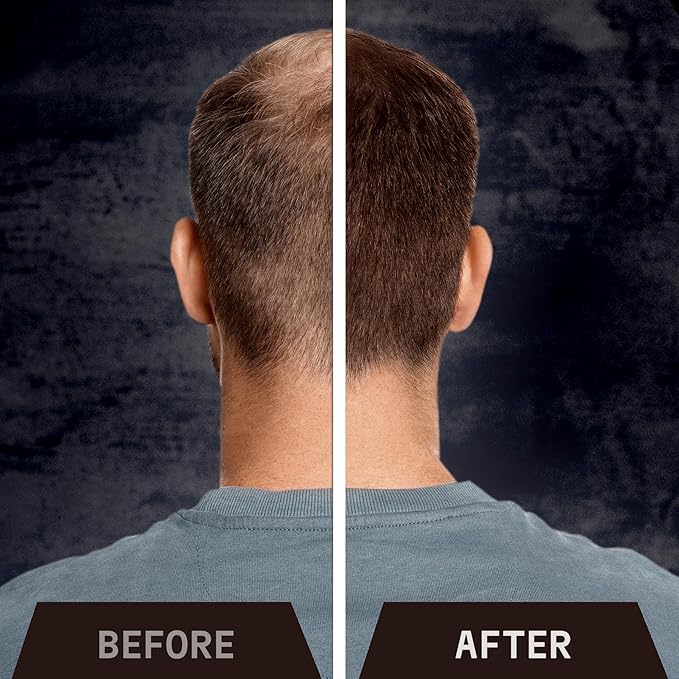 Striking Viking Hair Fibers for Thinning Hair, Dark Brown (28g) - Long Lasting, Undetectable Natural Building Powder for Thicker Looking Results, Men & Women