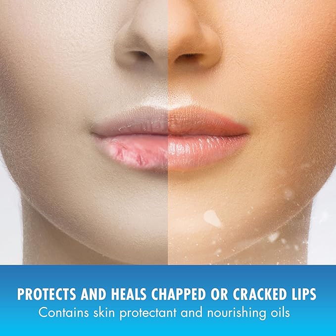 Mentholatum (R) Natural Ice (R) Sport Broad Spectrum SPF 30 Medicated Lip Balm - 12 Pack of 4.5 g Tubes