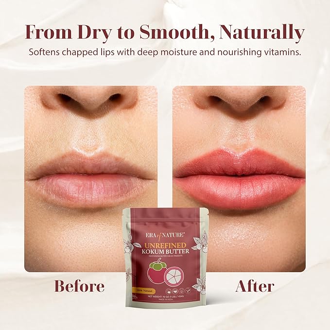 era of nature Kokum Butter Raw - 16 oz (1lb) - Natural Butter for Body Butters, Lotion Bars, Lip Balm, Soap Making – Blends Well with Shea or Cocoa Butter – For Stretch Marks, Scars, Pregnancy Care