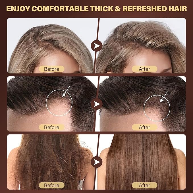 Scalp Scrub, 2-in-1 Scalp Exfoliator & Clarifying Shampoo for Dandruff, Dry, Itchy Scalp & Hair Growth, Batana Oil & Rosemary Scalp Treatment with Scalp Massager for Buildup & Thinning Hair, 10.93 oz