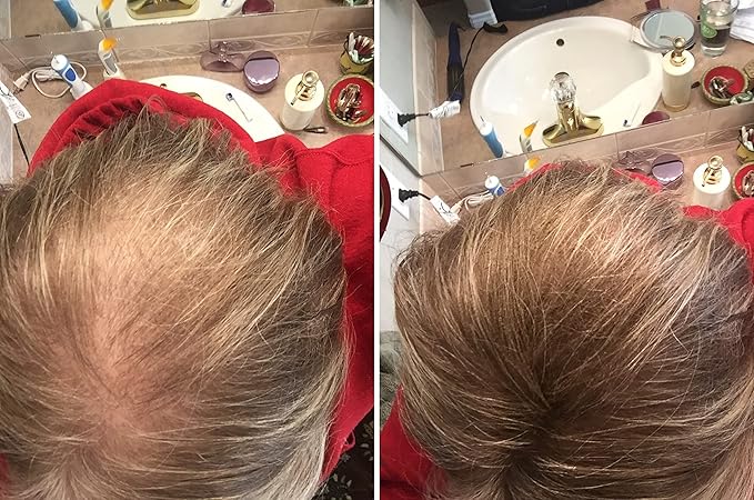 Quick Fix For Thinning Hair and Bald Spot. Get 10X Fuller Hair Instantly. All-Natural Hair Building Fiber For Hair. Trial Size (10-Day Supply). Light Brown